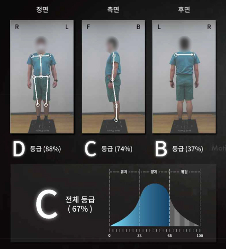 개선전 이미지