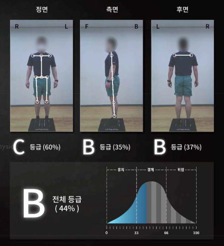 개선후 이미지